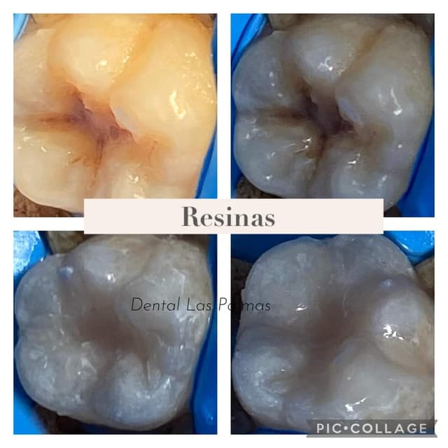 Resinas